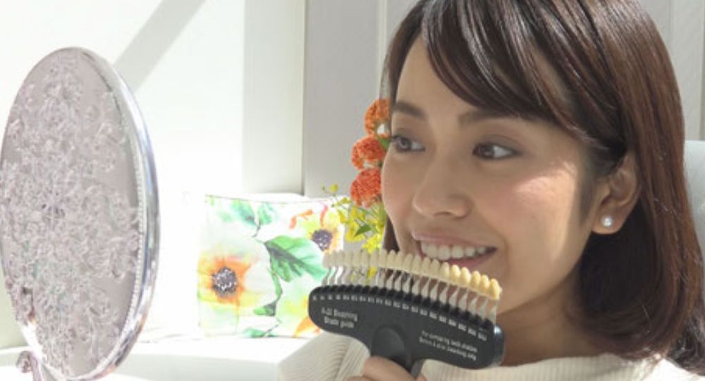 山口のセルフホワイトニングBeauty-Salon-CALME