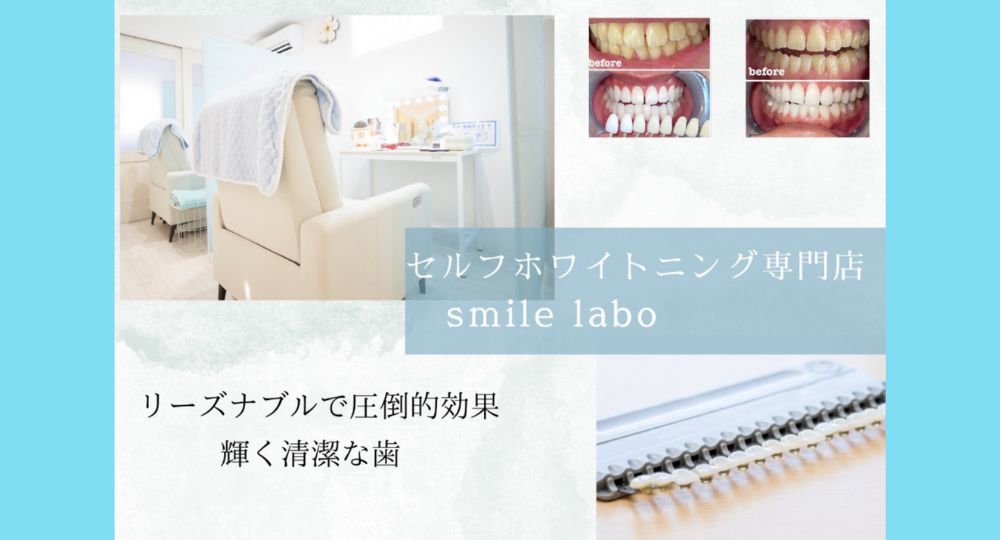 鹿児島のセルフホワイトニング鹿児島ホワイトニング専門店smile labo 谷山店